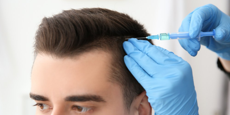 Haartransplantation türkei empfehlung: Die Wahl des richtigen Verfahrens